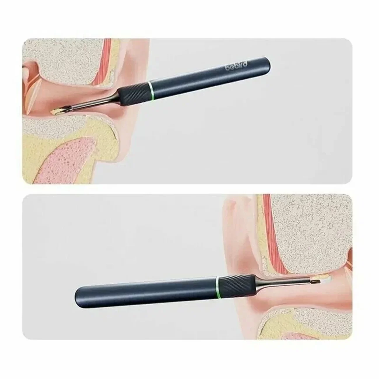 Умная ушная палочка Xiaomi Bebird Ear Picking Stick Note 5 White Умная ушная палочка Xiaomi Bebird Ear Picking Stick Note 5 White